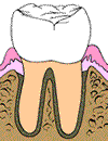 healthy gums